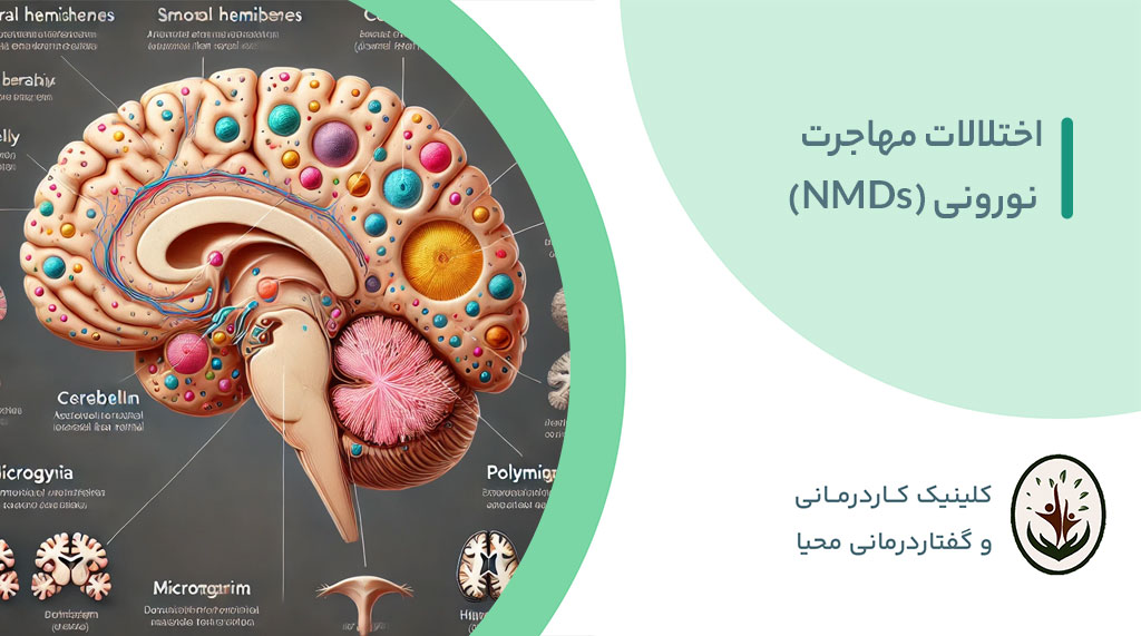 Read more about the article اختلالات مهاجرت نورونی (NMDs)